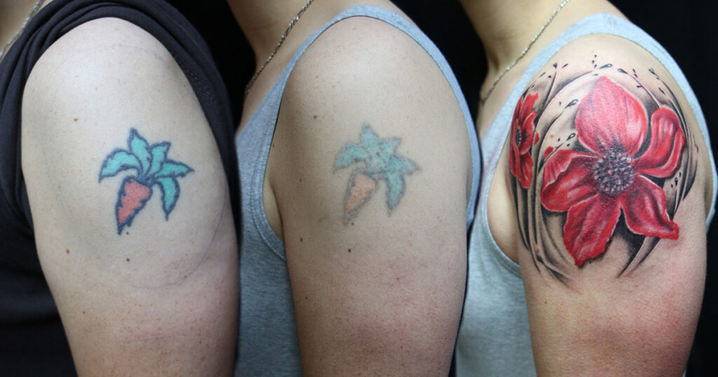 Cuánto cuesta un cover up